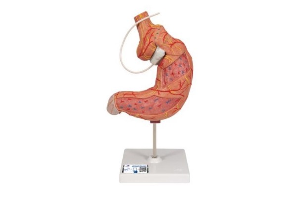 model żołądka ludzkiego z opaską żołądkową, 2 części - 3b smart anatomy - 1012787 [k15/1] 3b scientific modele anatomiczne 2